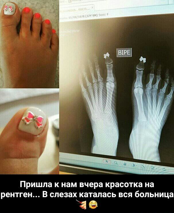 Пришла к нам вчера красотка на рентген В слезах КЗТЗПЗСЬ ВСЯ больница _