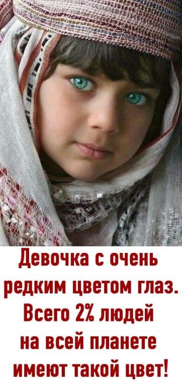 Девочка оочень редким цветом глаз Всего 21 людей на всей планете имеют такой цвет