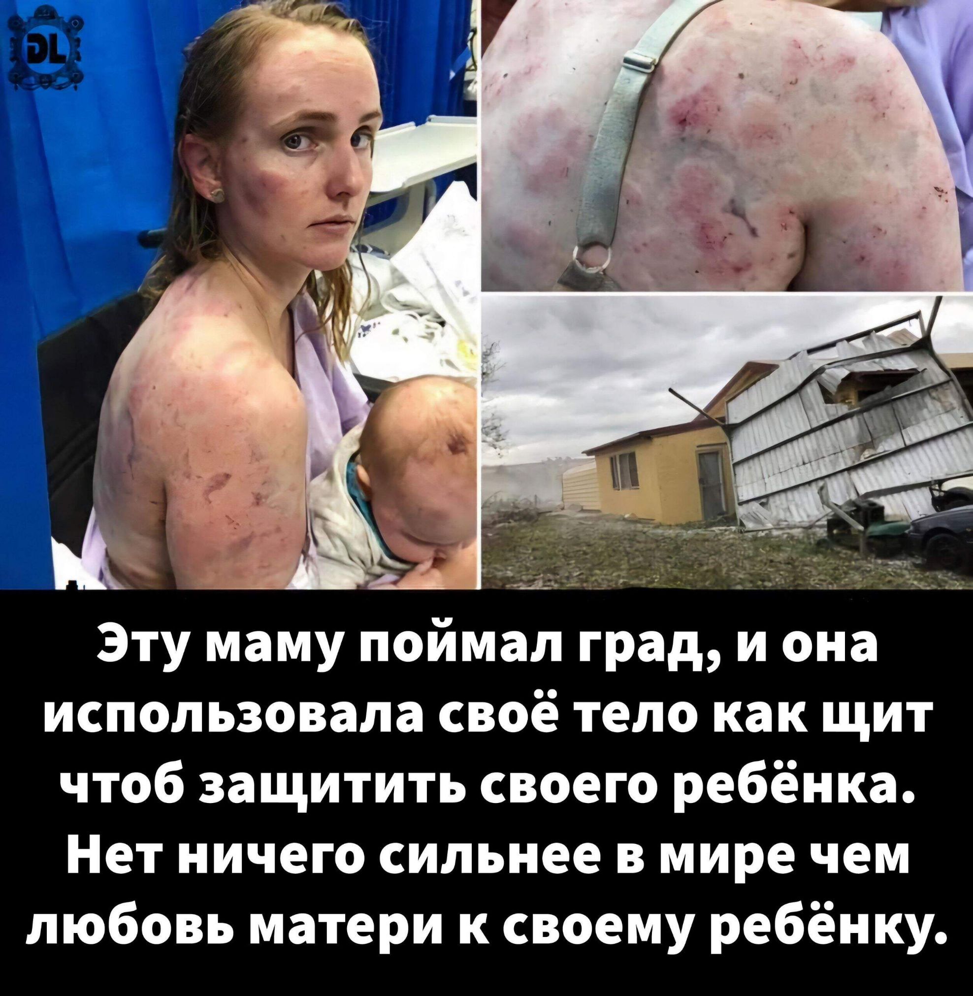 Эту маму поймал град, и она использовала своё тело как щит, чтоб защитить своего ребёнка. Нет ничего сильнее в мире, чем любовь матери к своему ребёнку.