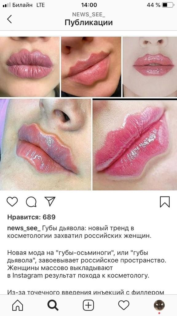 1400 44 ЕЕ мвшз_5вв_ Публикации О Нравится 689 пеш5_5ее_ Губы дьявола новый тренд в КОСМЕТОЛОГИИ ЗЗХВЭТИП РОССИЙСКИХ женщин Новая мода на губыосьминоги или губы дьявола завоевывает российское пространство Женщины массово выкладывают в пзса9гат результат похода к косметологу Иаза точечного введения инъекций С Фиппеоом 1 О