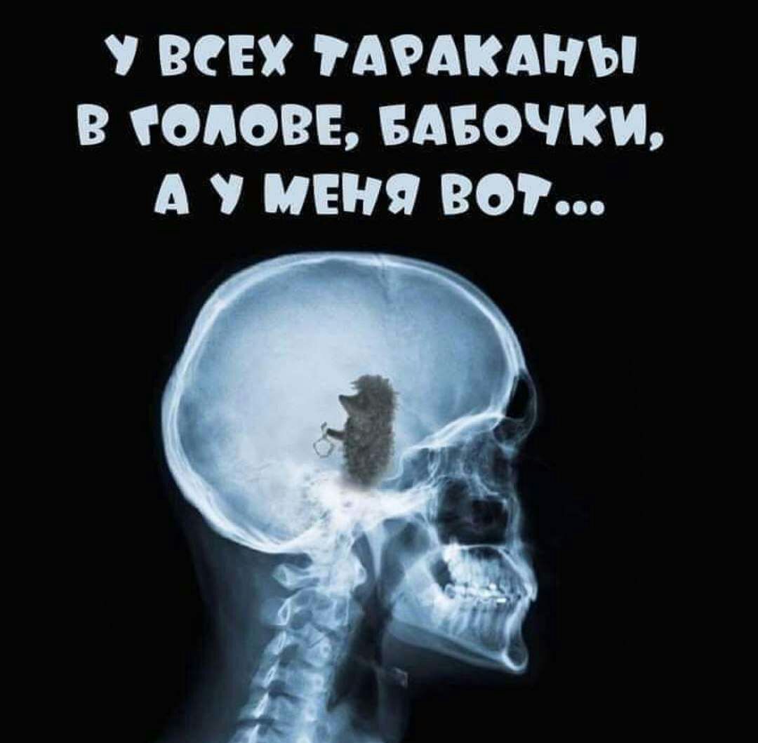 РСБУ АРАКАНЫ В ОПОВБ БАБОЧКИ А У МЕНЯ 807