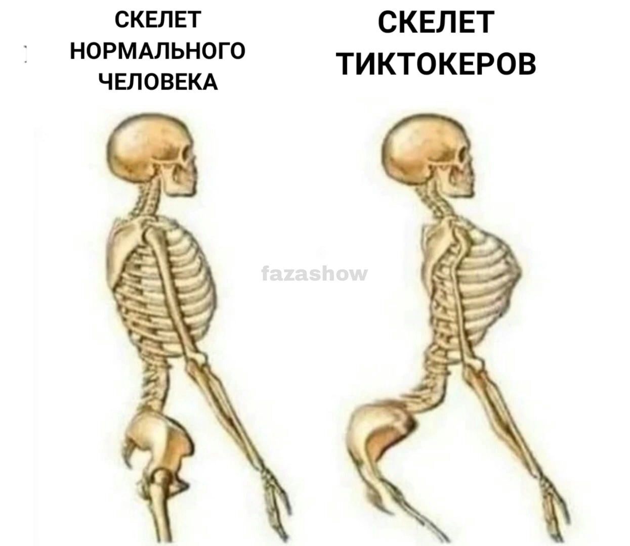 СКЕЛЕТ скЕлЕТ НОРМАЛЬНОГО шов тиктокнров