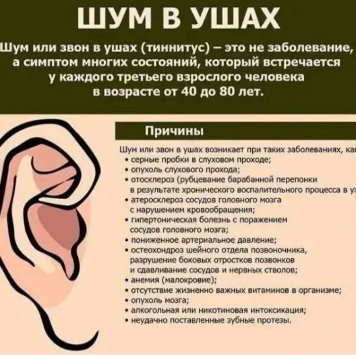 ШУМ В УШАХ ум или звон в ушах тиннитус это не заболевание а симптом многих состояний который встречается у каждого третьего взрослого человека в возрасте от 40 до 80 лет Шун илм эвон о ушах вазникает при таких заболеваниях км серные пробки в слуовом проходе спухоль слуховсго прохода отосклеро рубцевание барабанной перепоми в результате хронического