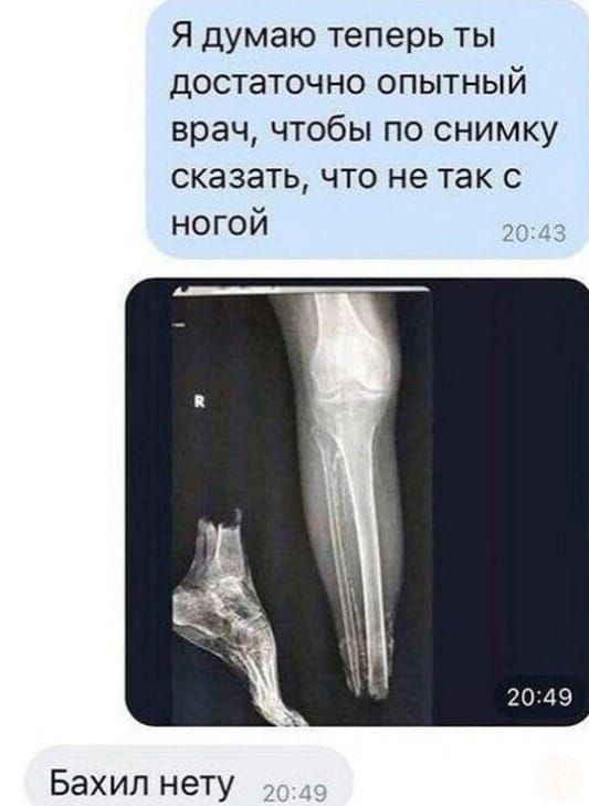 Я думаю теперь ты достаточно опытный врач чтобы по снимку сказать что не так с ногой Бахил нету