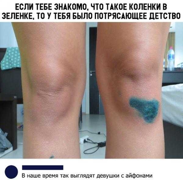 ЕСЛИ ТЕБЕ ЗНАКОМО ЧТО ТАКОЕ КПЛЕНКИ В ЗЕЛЕНКЕ ТП У ТЕБЯ БЫЛО ПОТРЯСАЮЩЕЕ дЕТСТВП _ В наше время так выглядят девушки с айфпнами