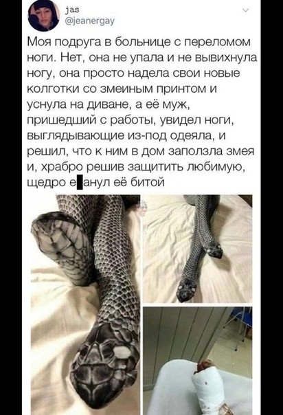 Моя подруга в больнице с переломом ноги Нет она не упала и не вывихнупа ногу она просто надела свои новые колготки со змеиным принтом и уснула на диване а её муж пришедший с работы увидел ноги выглядывающие из под одеяла и решил что к ним в дом залолзла змея и храбро решив защитить любимую щедро еанул ее битой