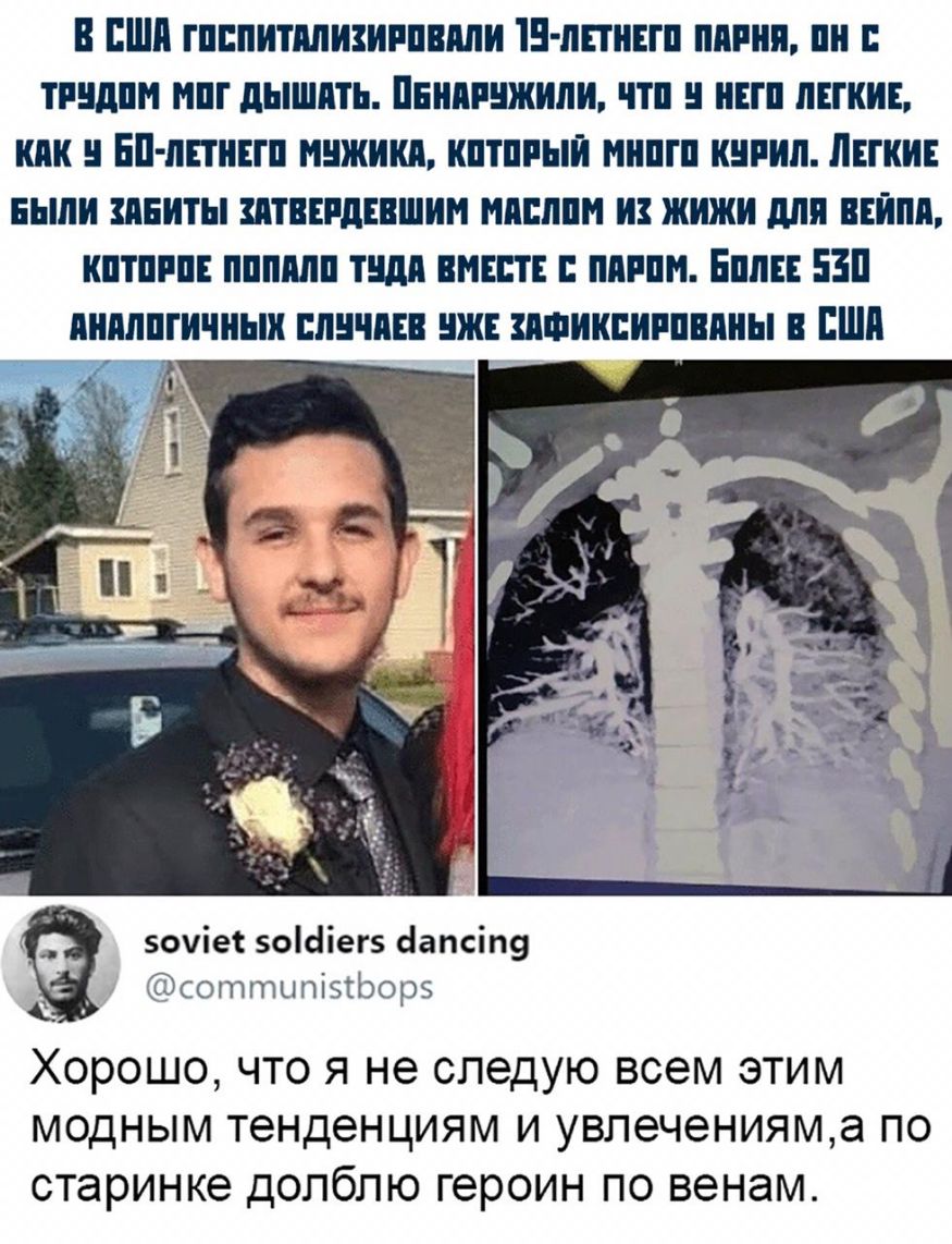 В США ГПШИТШИЗИРПВМИ В ЛЕТНИЕ ЛПНП НДПИ дЬШШТЬ ПЕПМШКИПИ ПП ЕП ЛЕГКИЕ ШШ ЕПППИЕШ мнжикл КПШРЫЙ ШШШ КИРИП ЛЕТНИЕ выпи НЕИТЫ ШТВЕРДЕВШИН МПП И ЖИЖИ для ВЕЙМ КПТПРПЕ ППШШП ТЩШ ВМЕСТЕ МММ ЕМЕЕ 53 янилпгичнык ШШШЕВ ЖЕ ИФИКЕИРППШЫ В Ш эоуіет ос1іег5 сіапсіп9 сотпшпізгЬорэ ХОРОШО ЧТО Я не следую ВСЭМ ЭТИМ МОДНЫМ тенденциям И УВПЭЧЭНИЯМЗ ПО старинке ДОЛбПЮ героин ПО венам