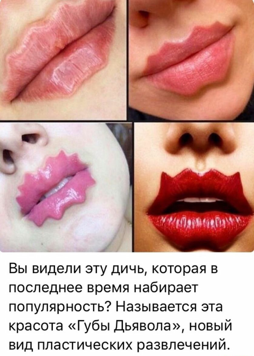 Вы видели эту дичь которая в последнее время набирает популярность Называется эта красота Губы Дьявола новый вид пластических развлечений