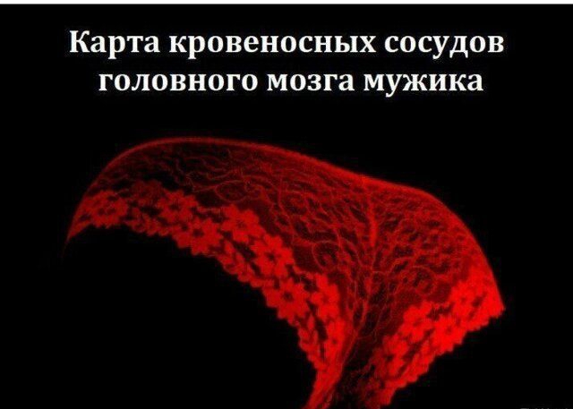 Карта кровеносных сосудов головного мозга мужика