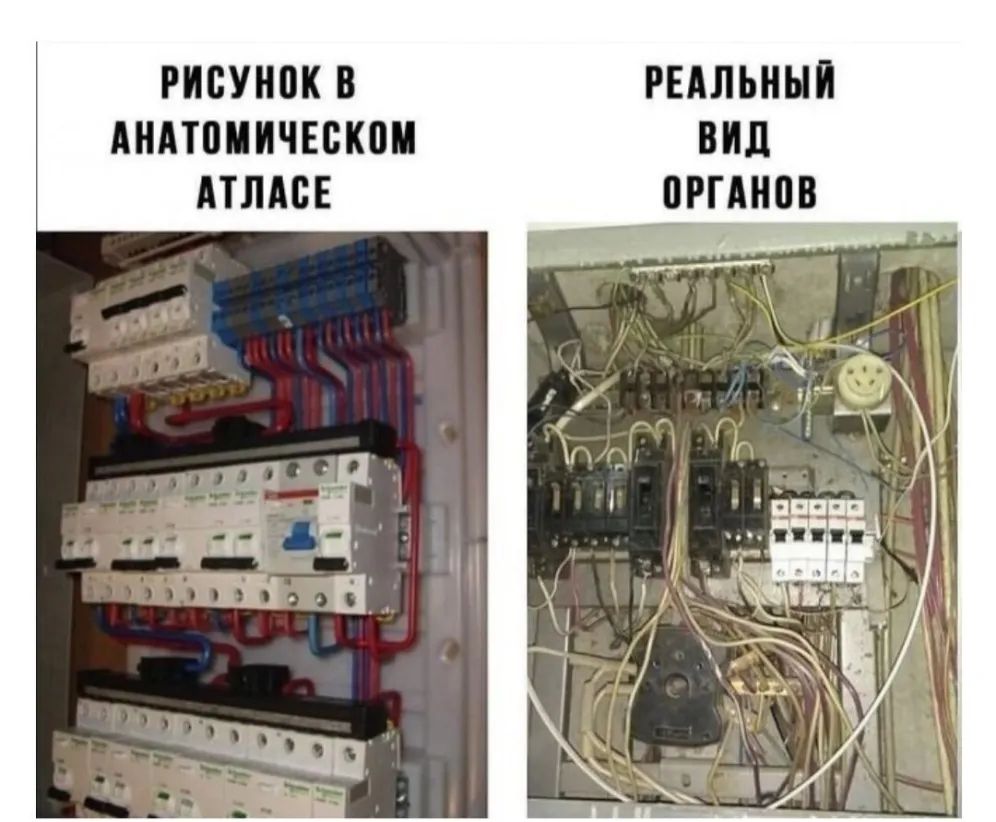 РИСУНПК В РЕАЛЬНЫЙ АНАТПИИЧЕБКОИ ВИД АТЛАБЕ ПРГМЮВ
