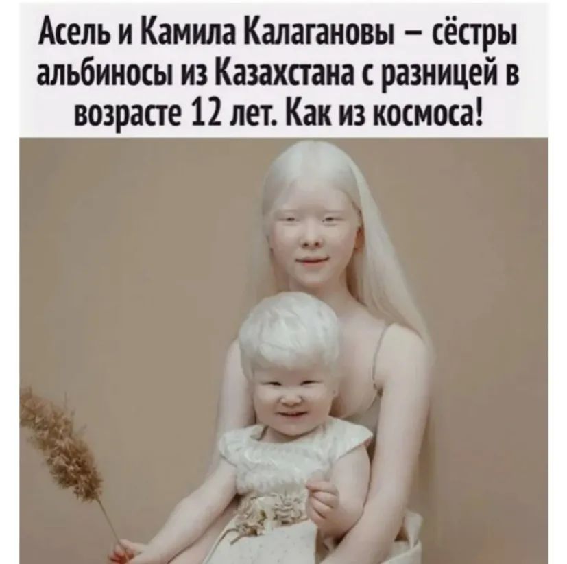 Асель и Камила Калапновы сёстры альбиносы из Казахстана разницей в возрасте 12 лет Как из космоса