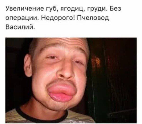 Увеличение губ, ягодиц, груди. Без операции. Недорого! Пчеловод василий.