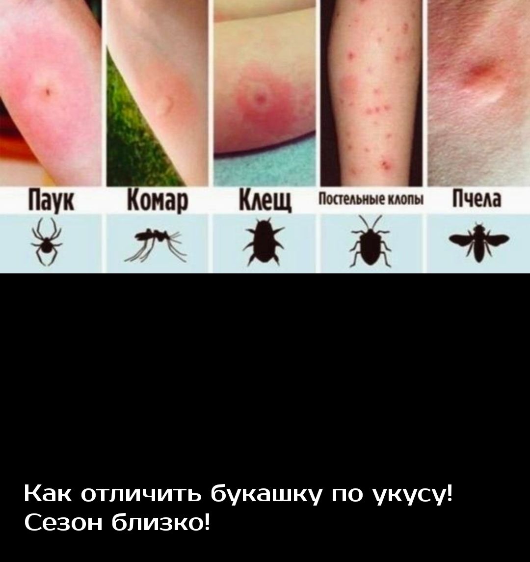 комар кдещ Попедьныекдопд Пчеда ддт Как отличить букашку по укусу Сезон близко