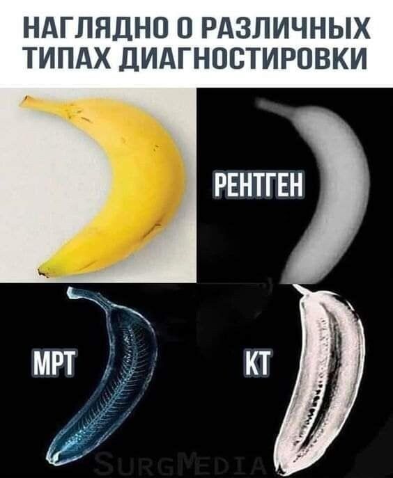НАГЛНДНО О РАЗЛИЧНЫХ ТИПАХ ДИАГНОСТИРПВКИ РЕНТГЕН
