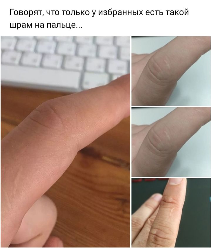 ГОВОРЯТ ЧТО ТОЛЬКО у избранных есть такой шрам на пальце