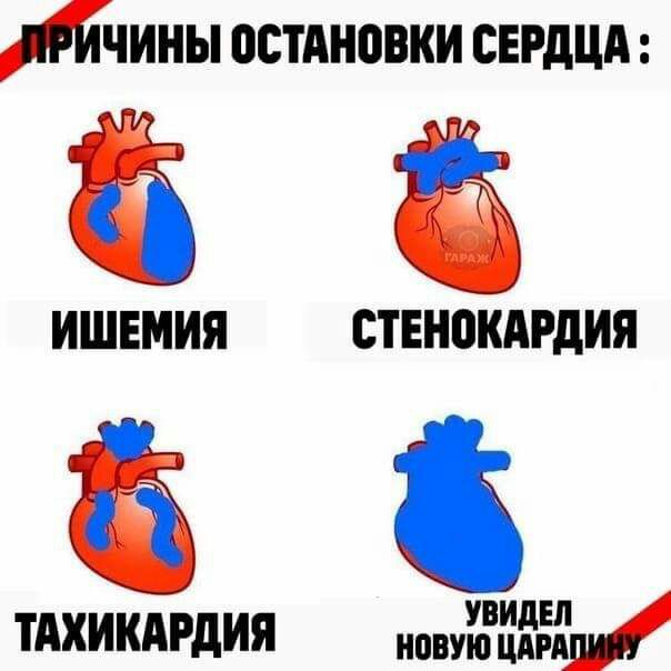 Лчины остдновки сердцд ЁЁ ИШЕМИЯ ствнокдгдия тдхикдгдия новуЁЁЁЁ