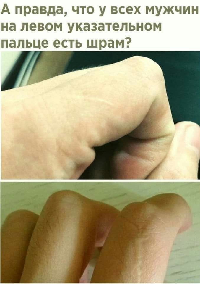 А правда что у всех мужчин на левом указательном пальце есть шрам