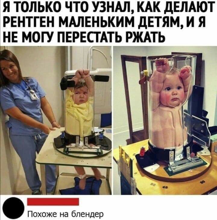 я только что УЗНАЛ КАК дЕЛАЮТ рентген мдлвньким детям и я нв__мо_гу перестдть ржАть Похоже на блендер