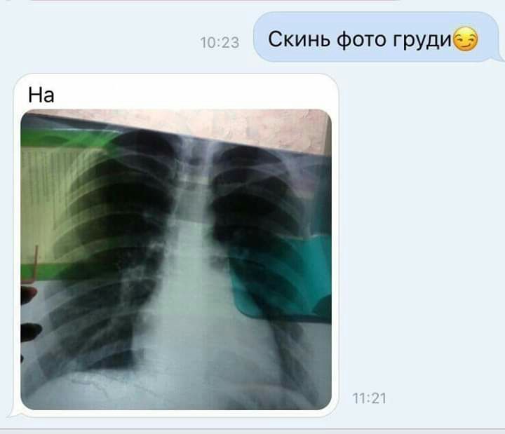 Скинь фото груди