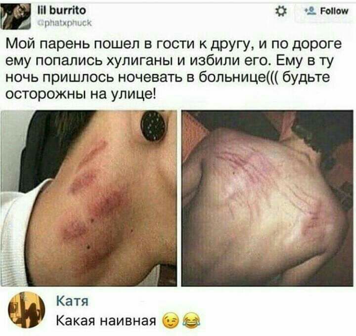 Ьиггію О гоним рычит Ъ Мой парень пошел в гости к другу и по дороге ему попались хулиганы и избили его Ему в ту ночь пришлось ночевать в больнице будьте осторожны на улице _ Катя Какая наивная