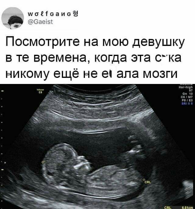_Ёьь Посмотрите на мою девушку в те времена когда эта с ка никому ещё не е апа мозги см иви