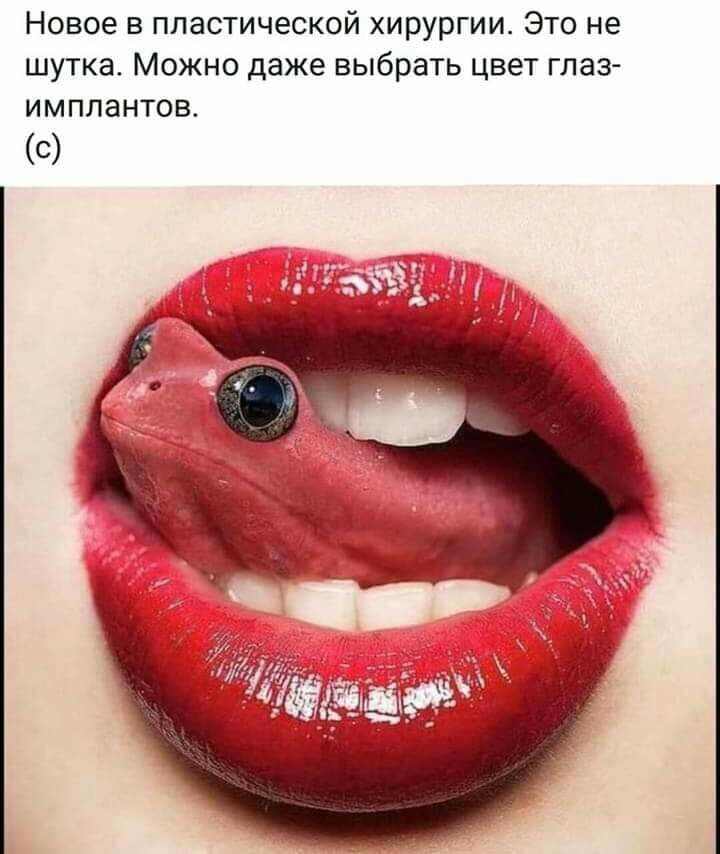 Новое в пластической хирургии Это не шутка Можно даже выбрать цвет глаз имплантов С