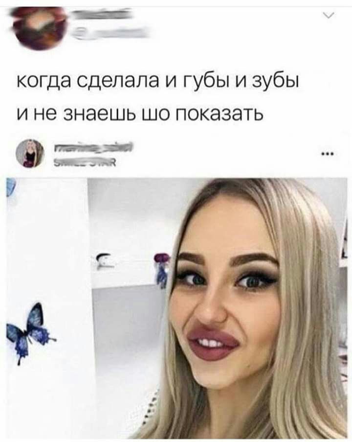 когда сделала и губы и зубы и не знаешь шо показать __ ддт