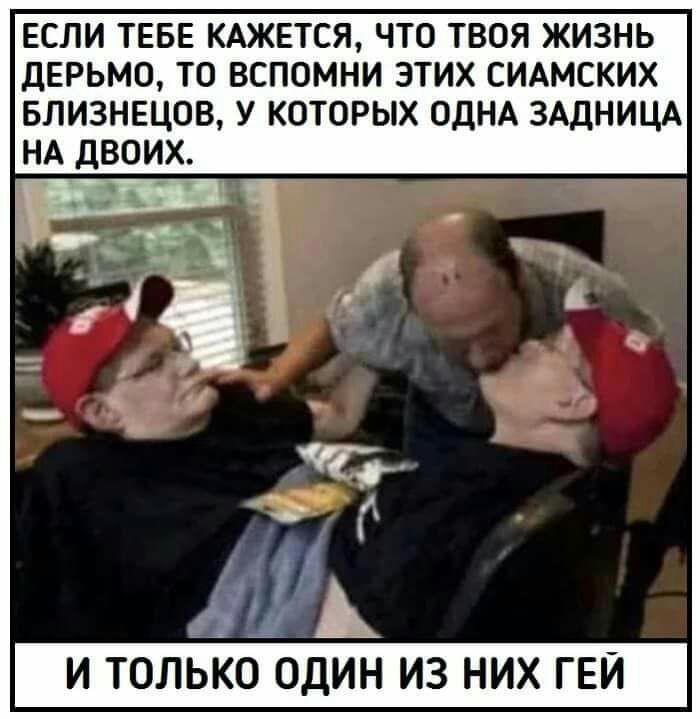 ЕСЛИ ТЕБЕ КАЖЕТСЯ ЧТО ТВОЯ ЖИЗНЬ ДЕРЬМО ТО ВСПОМНИ ЭТИХ СИАМСКИХ БЛИЗНЕЦОВ У КОТОРЫХ ОДНА ЗАДНИЦА НА ДВОИХ