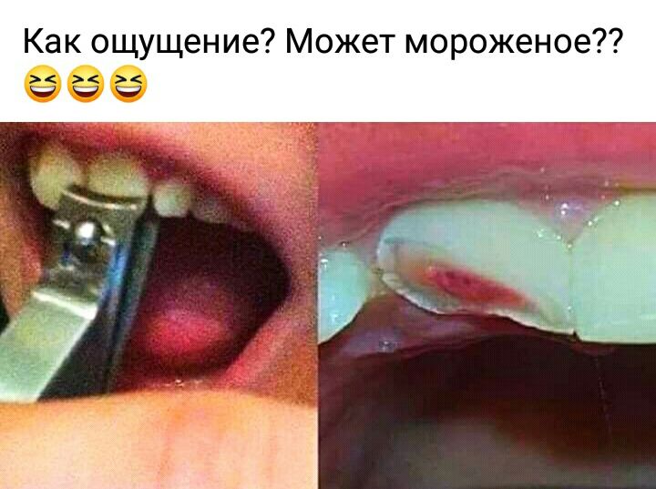 Как ощущение Может мороженое