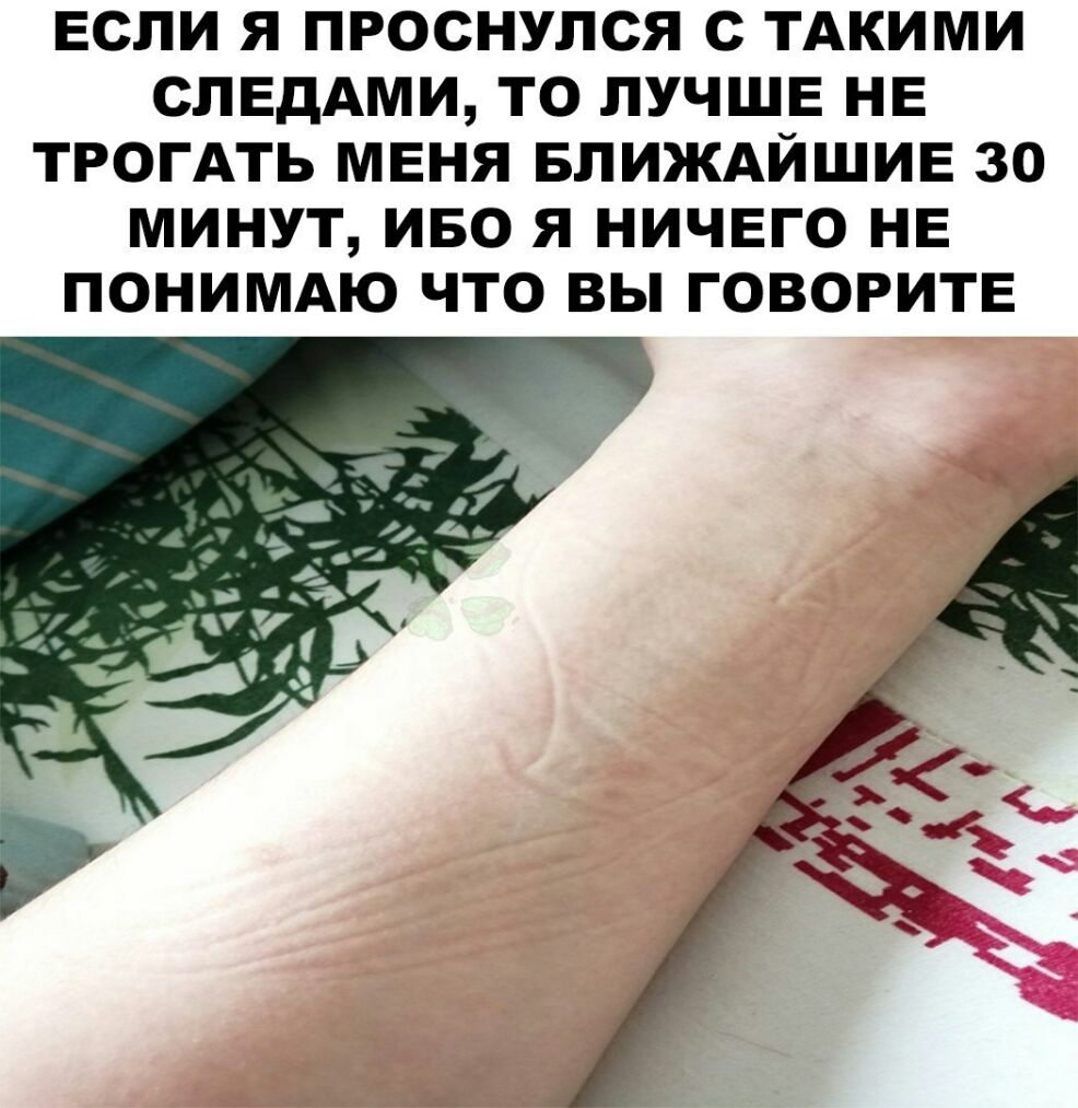 ЕСЛИ Я ПРОСНУПСЯ С ТАКИМИ СЛЕДАМИ ТО ЛУЧШЕ НЕ ТРОГАТЬ МЕНЯ БЛИЖАЙШИЕ 30 МИНУТ ИБО Я НИЧЕГО НЕ ПОНИМАЮ ЧТО ВЫ ГОВОРИТЕ