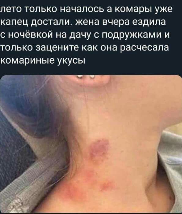 лето только началось а комары уже капец достали жена вчера ездила с ночёвкой на дачу с подружками и только зацените как она расчесала комариные укусы