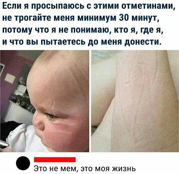 Если я просыпаюсь с этими отметинами не трогайте меня минимум 30 минут потому что я не понимаю кто я где я и что вы пытаетесь до меня донести ЭТО НЕ МЕМ ЭТО МОЯ ЖИЗНЬ