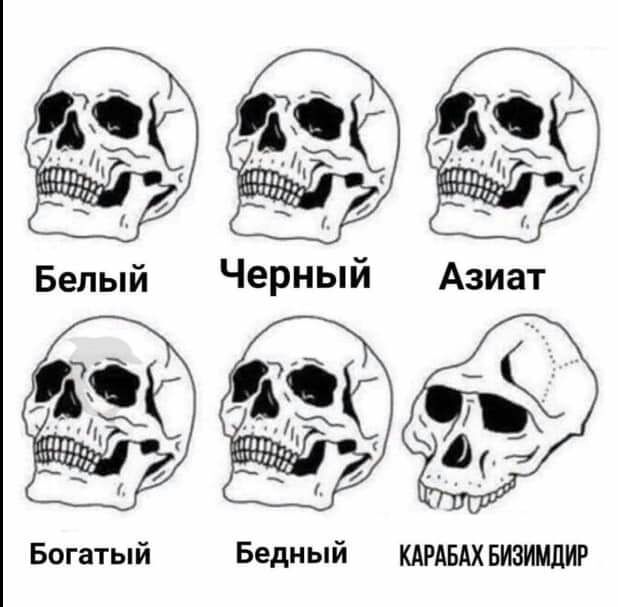 Черный Азиат Богатый Бедный КАРАБАХ БИЗИМДИР