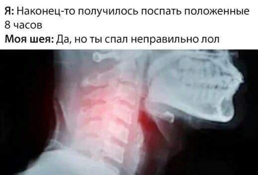 Я НЕКОНЭЦЧО ПОПУЧИПОСЬ ПОСГШТЬ положенные 8 часов Моя шея Да но ты пап неправильно поп