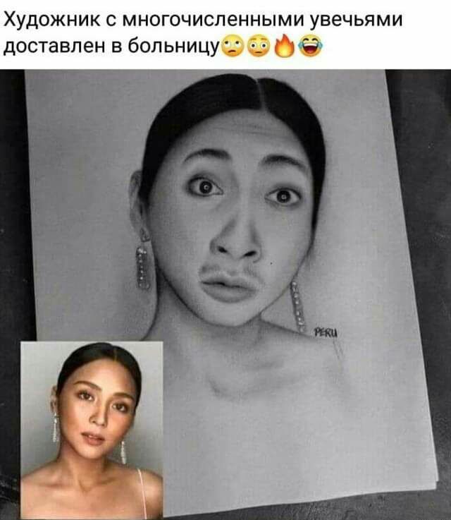 Художник с многочисленными увечьями доставлен в больницу _ 7 7