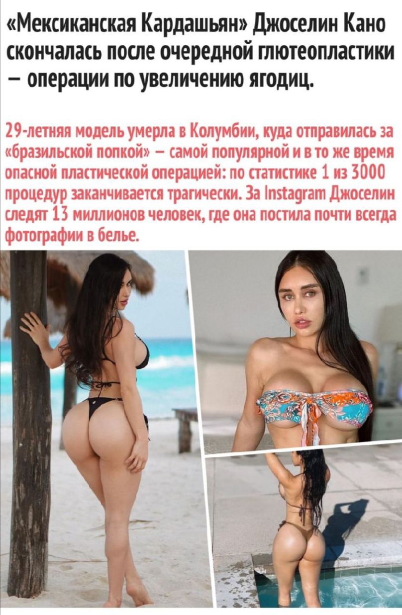 Мексиканская Кардашьян Джоселин Кано скончалась после очередной глютеопластики операции по увеличению ягодиц