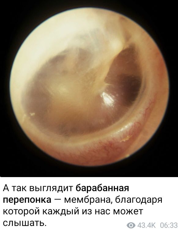 А так выглядит барабанная перепонка мембрана благодаря которой каждый из нас может слышать