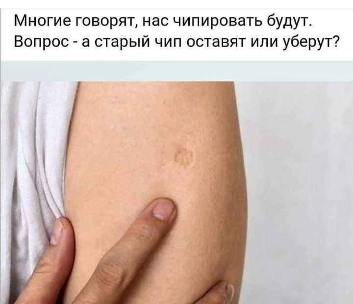 Многие говорят нас чипировать будут Вопрос а старый чип оставят или уберут