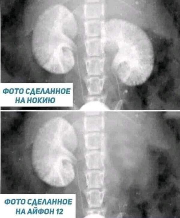 ФОТО СДЕЛАННОЕ НА НОКИЮ оста СДЕААННОЕ идтэон 12 Ь