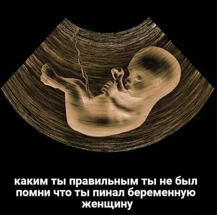 КЭКИМ ТЫ ПРЗВИЛЬНЫМ ТЫ не был ПОМНИ ЧТО ТЫ ПИНЗЛ беременную женщину