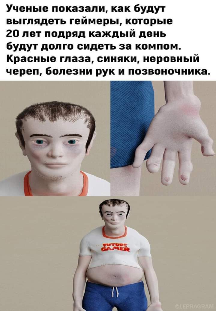Ученые показали как будут выглядеть геймеры которые 20 лет подряд каждый день будут долго сидеть за компом Красные глаза синяки неровный череп болезни рук и позвоночника