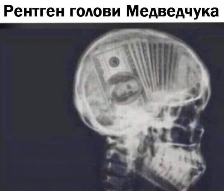 Рентген годови Медведчука