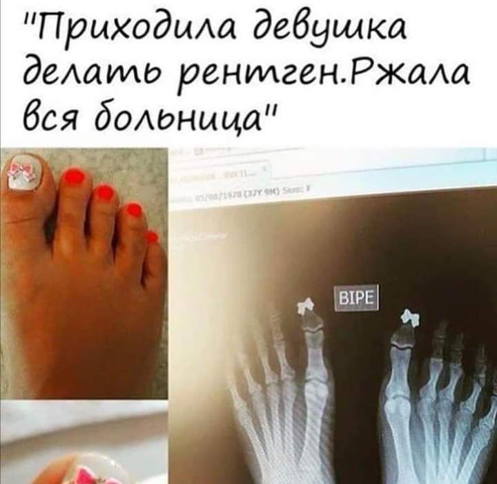 Приходиха дедушка деАаИш рентгенжма бая болоныца