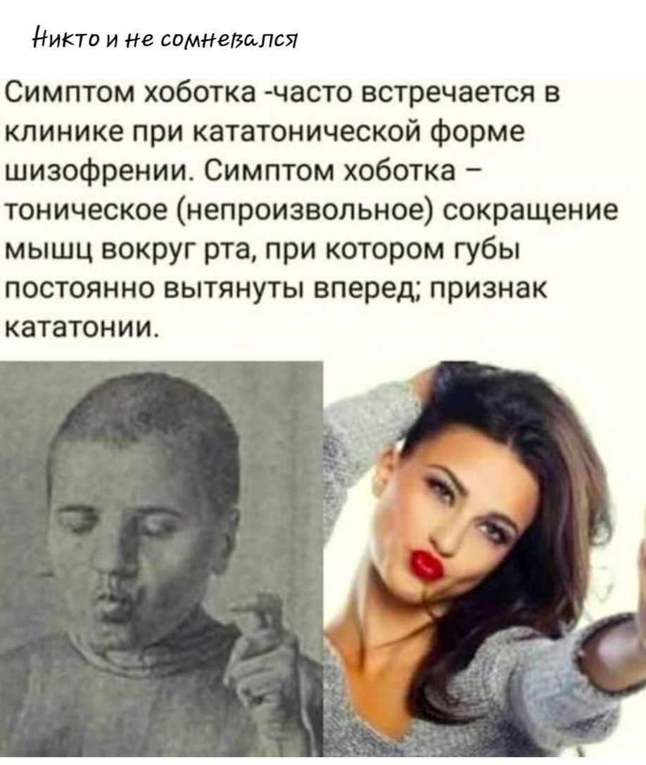 Никто и не сомневался Симптом хоботка часто встречается в клинике при кататонической форме шизофрении Симптом хоботка тоническое непроизвольное сокращение мышц вокруг рта при котором губы постоянно вытянуты вперед признак кататонии