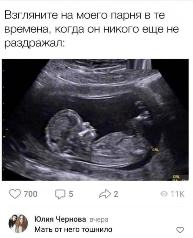Взгляните на моего парня в те времена когда он никого еще не раздражал 700 Юлия Чернова Мать от него тошнило