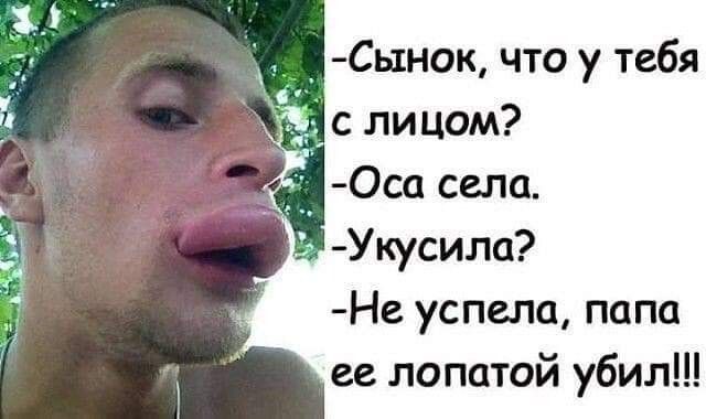Сынок что у тебя с лицом Оса села _ Укусила Не успела папа ее лопатой убил