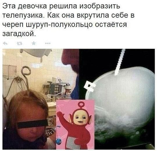 Эта девочка решила изобразить тепепузика Как она вкрутипа себе в череп шуруп полукольцо остаётся загадкой