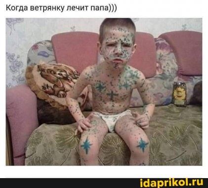 Когда ветрянку лечит папа
