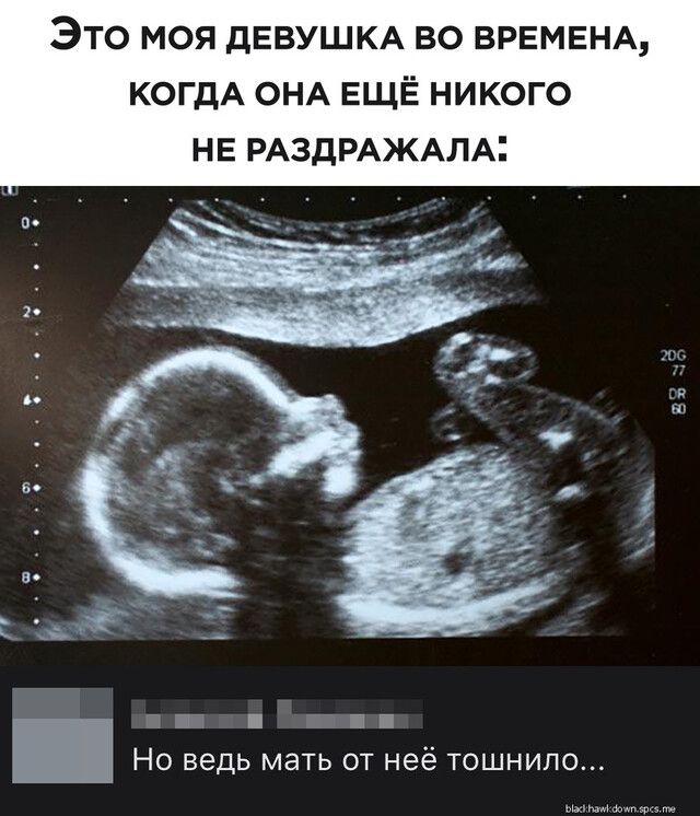 ЭТО МОЯ ДЕВУШКА ВО ВРЕМЕНА КОГДА ОНА ЕЩЁ НИКОГО НЕ РАЗДРАЖАЛА 7 П 1 Но ведь мать от неё тошнило