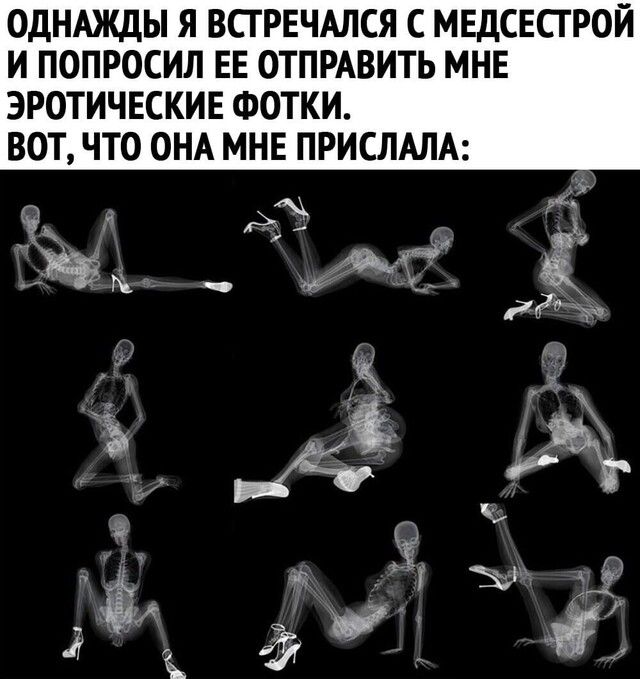 ОДНАЖДЫ Я ВСГРЕЧАЛСЯ С МЕДСЕСГ РОЙ И ПОПРОСИЛ ЕЕ ОТПРАВИТЬ МНЕ ЭРОТИЧЕСКИЕ ФОТКИ ВОТ ЧТО ОНА МНЕ ПРИСЛАЛА